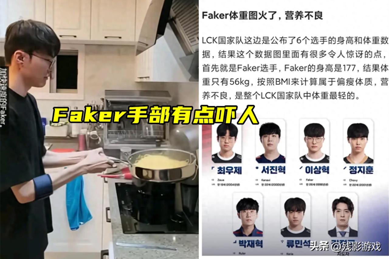 Faker五冠王背后的代价！他的手型为何如此吓人？职业选手的辛酸你了解多少？