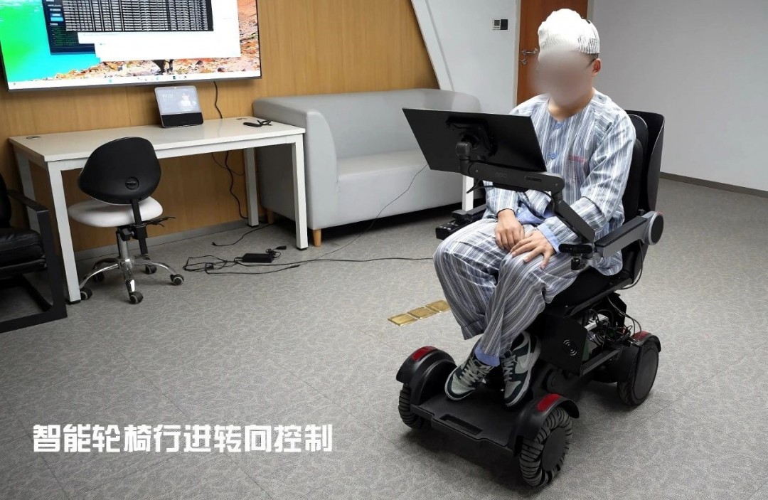 黄雪辰完美动作实现突破__脑外伤性癫痫