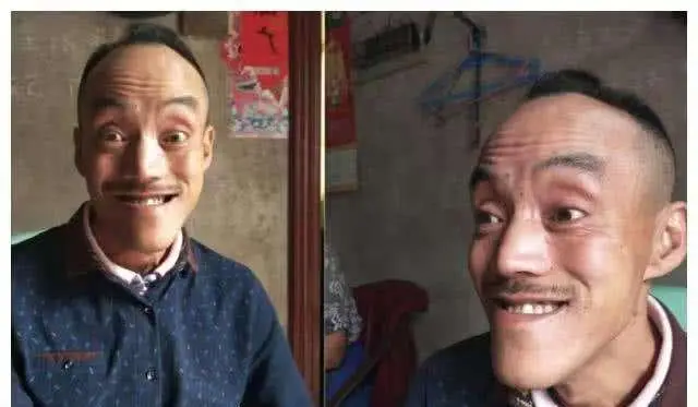 光头真实照片__光头实录