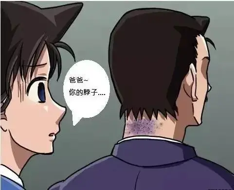_毛利小五郎麻醉中途醒来_毛利小五郎对麻醉针没有反应