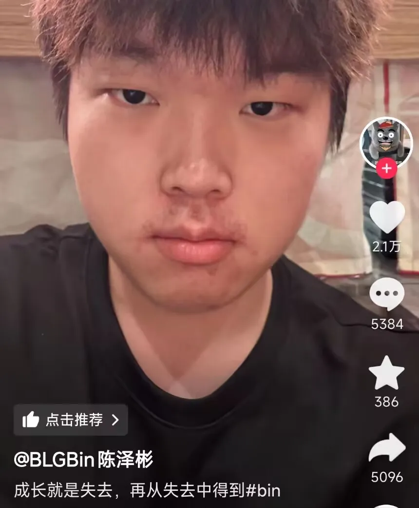 欧联杯冠军奖杯叫什么__澳网冠军奖杯